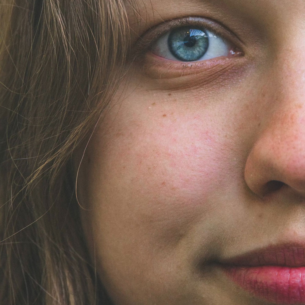 close up of a white woman's cheek and blue eye